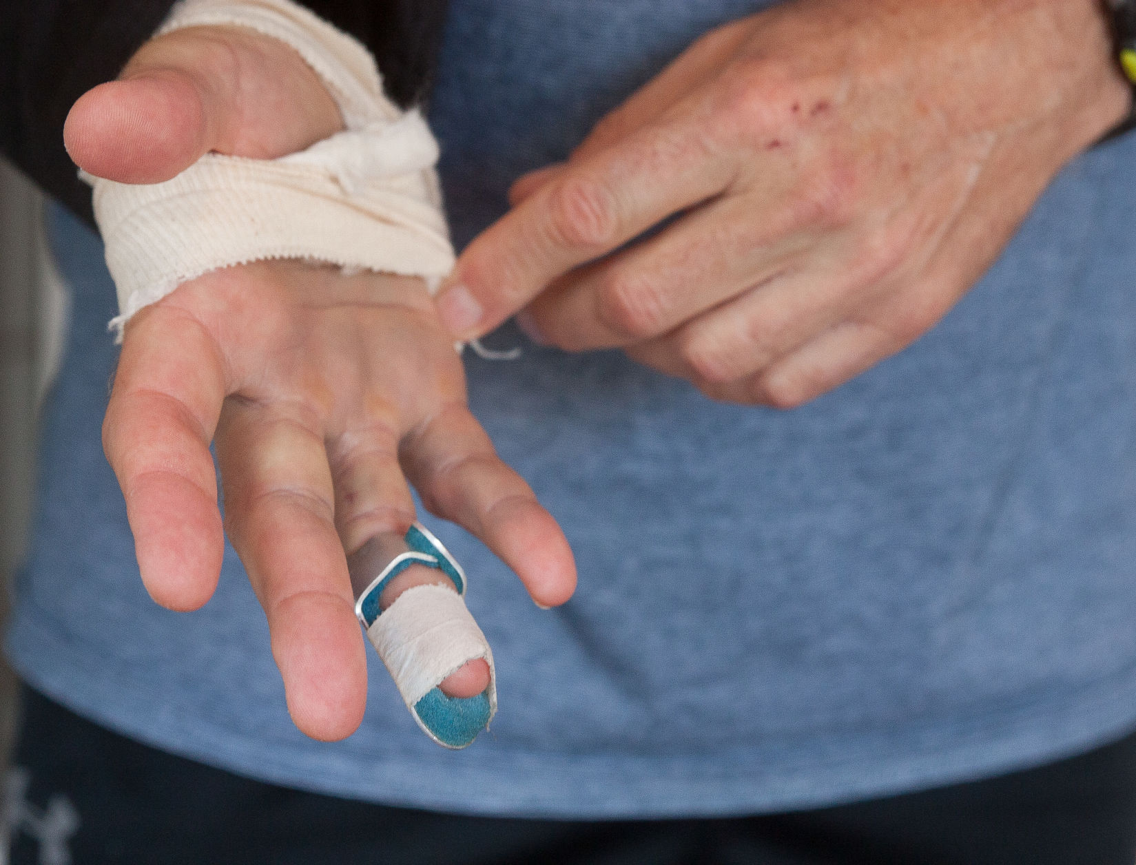Injuries